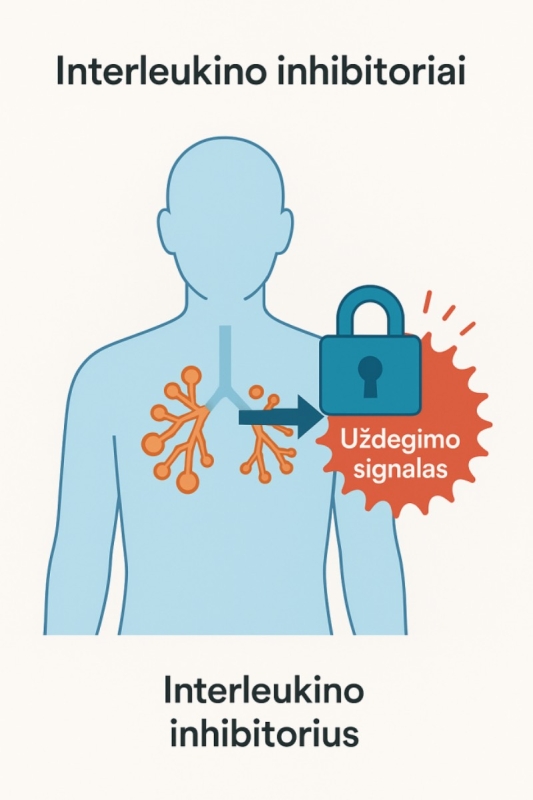 Interleukino inhibitoriai: nauja era gydyme
